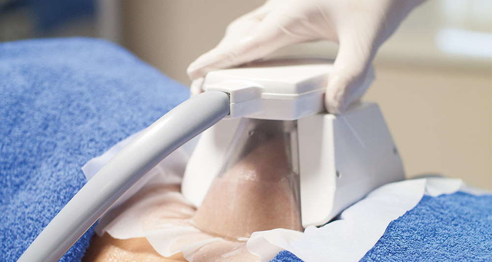 How Fat Freezing and HIFU Work Together? 2 Multiple Areas in One Session HIFU and Fat Freezing Busby