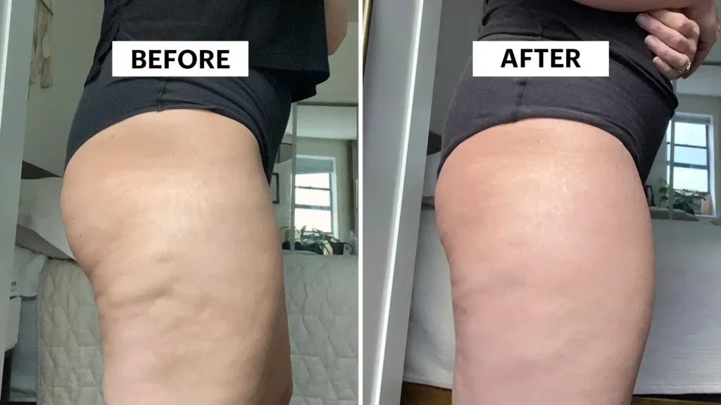 Do Toning Exercise Busby Really Tackle Cellulite?