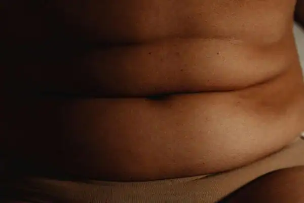 The Hidden Connection: How Stress Shapes Your Fitness and Body Composition 3 image of what stress can do on the stomach area and how Lipo 360 Busby can help to change your body shape.