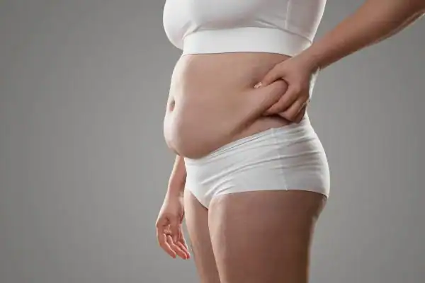 Image of stress belly Busby How Lipo 360 can help manage your symptoms
